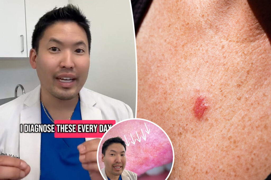 I am a dermatologist: These signs easily ignored on the skin may indicate cancer