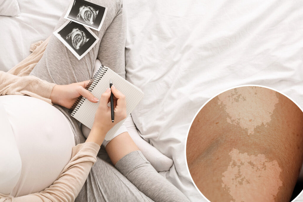 I joke a fungus infection as a baby name to my pregnant sister, and use it