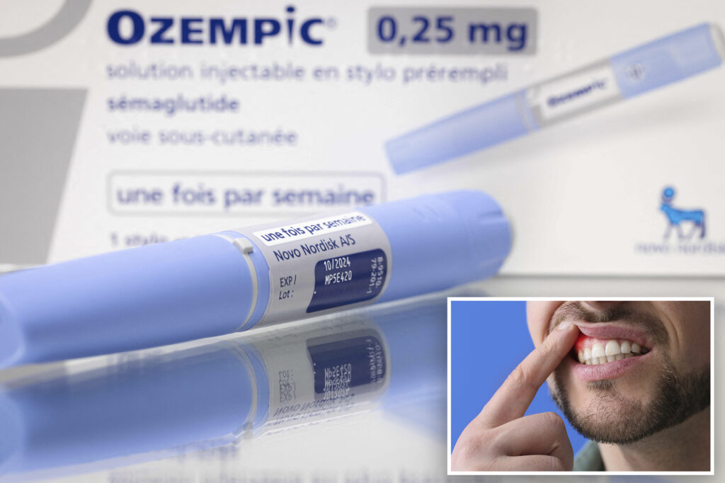 "Ozempic deeth" is the last alarming side effect of drugs to lose weight: "quite harmful"