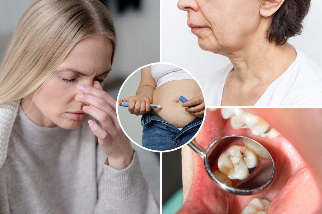 The weird side effects of GLP-1 weight loss drugs, from "ozempical feet" to cavities to a running nose